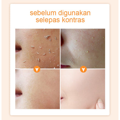 Gmeelan Whitening Cream Exfoliating Gel Cream Skin Care Moisturizing Sunscreen